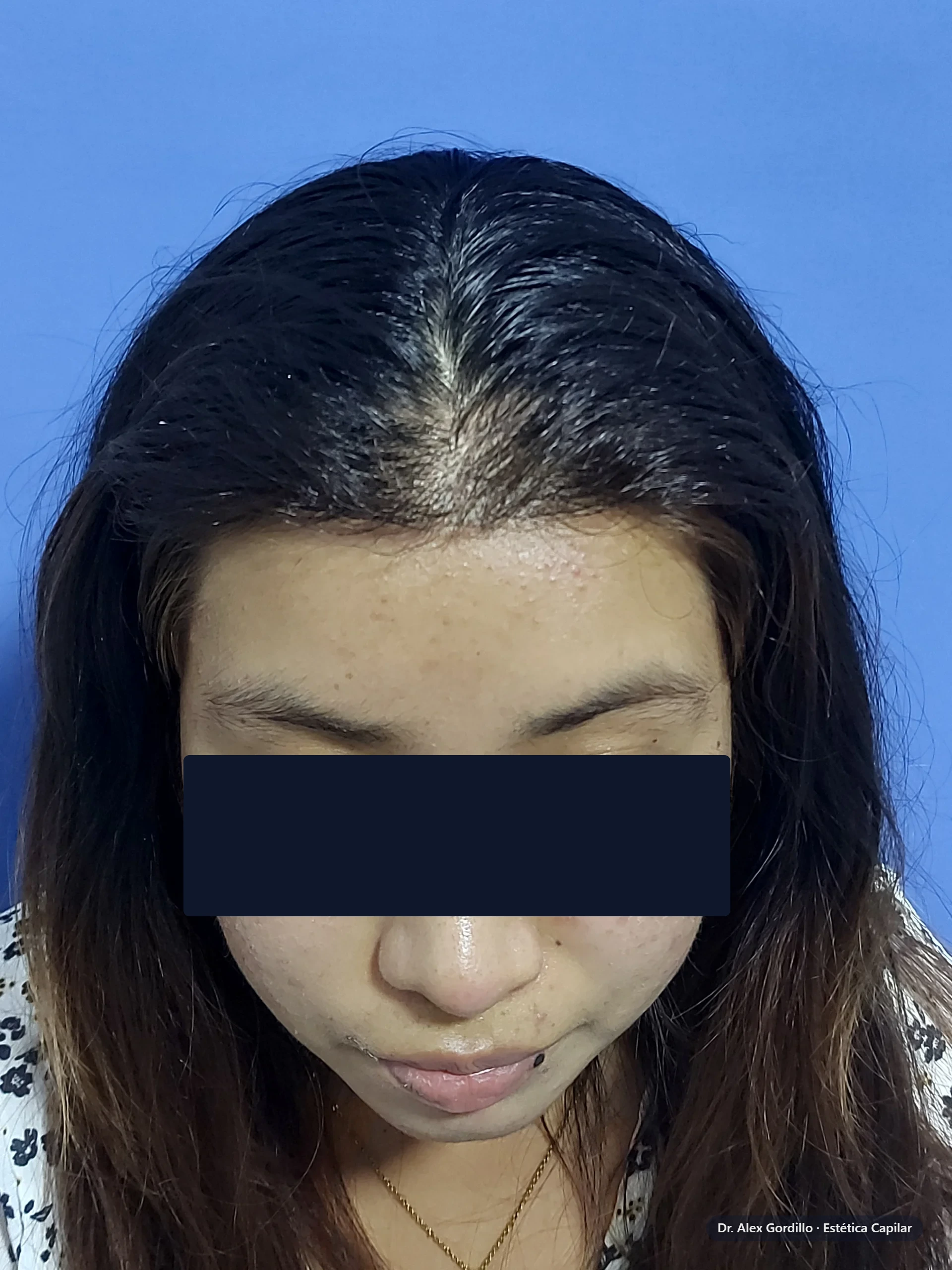Después — Edith M. (26 años)